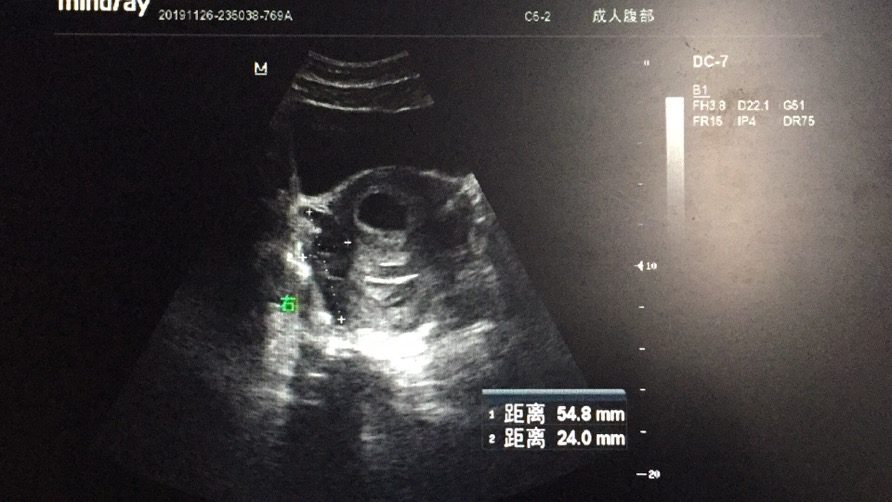 微信图片_20200817154554.png